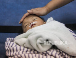 Penanganan Bibir Sumbing Anak melalui Bedah Plastik: Fakta Penting