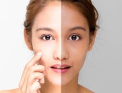 Tips Kulit Kusam dan Solusinya untuk Kulit Glowing