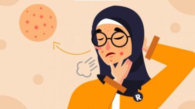 Mengatasi Muka Jerawatan Setelah Olahraga