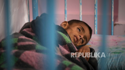 Gizi Buruk Akut pada 2.700 Balita di Gaza: PBB Berbicara