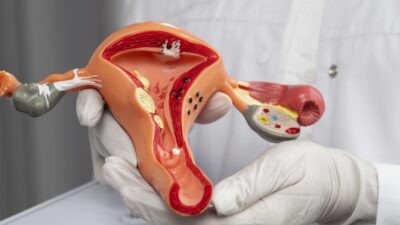 Rancang Ulang Spekulum Vaginal: Inovasi Untuk Kenyamanan Pasien