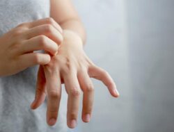 Dermatolog: Mengapa Anxiety Bisa Picu Jerawat dan Eksim?